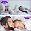 Anti Snoring Chin Strap, Stop Snoring Sleep Aid for Men and Women(Black)