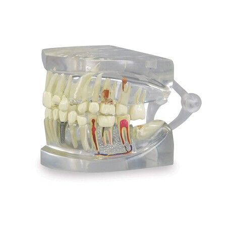 Clear Dental Model, Human Body Anatomy Replica of Jaw Teeth for Dentist Office Educational Tool