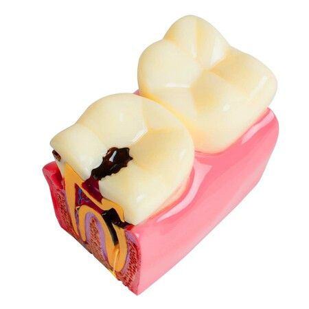 https://img.crazysales.com.au/products_pictures/297/297919_2576341_F.jpg