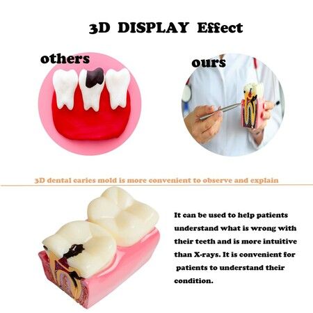 https://img.crazysales.com.au/products_pictures/297/297919_2576345_F.jpg