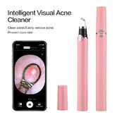 Smart Visual Blackhead Remover Acne Needle Cleansing Cosmetic Devices Acne Squeeze Pore Cleaner Facial Treatment With Camera Color Pink