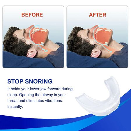 https://img.crazysales.com.au/products_pictures/321/321021_2796288_F.jpg
