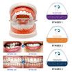 3 Stages Dental Orthodontic Braces Teeth Retainer Bruxism Mouth Guard Teeth Straightener Device