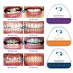 3 Stages Dental Orthodontic Braces Teeth Retainer Bruxism Mouth Guard Teeth Straightener Device