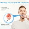 Tonsil Stone Remover Electronic Vacuum Stone Removal Kit, 5 Modes Instant Suction Tool, Easy to Use, Fresh Breath, Mouth Cleaning Oral Care
