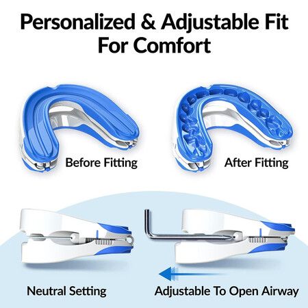 https://img.crazysales.com.au/products_pictures/333/333976_2926972_F.jpg