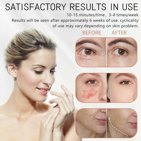 https://img.crazysales.com.au/products_pictures/344/344662_3033519_F.jpg