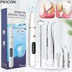 Professional Ultrasonic Dental Scaler - Effortlessly Remove Tartar and Stains