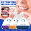 3-Stage Dental Orthodontic Braces/Teeth Retainer/Bruxism Mouth Guard-Correct Misalignment,Prevent Bruxism