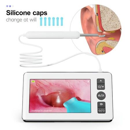 HD Visual Ear Cleaning Endoscope Professional 4.3 Inch Screen Otoscope Ear Wax Removal Tool