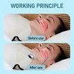 Professional Anti Snoring Device, 3 Speed Adjustment, Smart Snoring Solution, Breathe Easy, Sleep Soundly