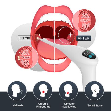 https://img.crazysales.com.au/products_pictures/360/360594_3209638_F.jpg