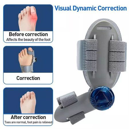 https://img.crazysales.com.au/products_pictures/360/360895_3214083_F.jpg