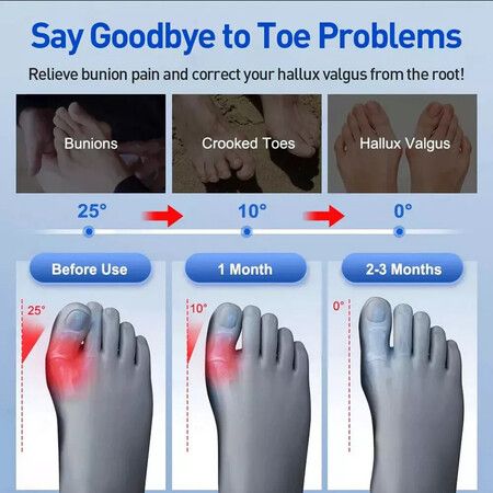 https://img.crazysales.com.au/products_pictures/360/360895_3214084_F.jpg