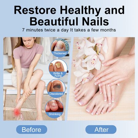 https://img.crazysales.com.au/products_pictures/360/360897_3214106_F.jpg