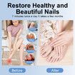 LED Nail Fungus Cleaning Light Device For Thick,Damaged,And Discolored Nails,For Home Use