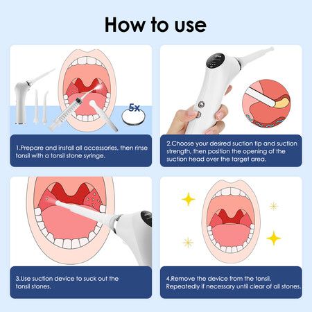 https://img.crazysales.com.au/products_pictures/362/362222_3228245_F.jpg