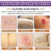 Silicone Scar Sheets 4 x 150cm, Silicone Scar Tape For Surgical, C-Section, Tummy Tuck, Keloid Scars, Keloid Bump Removal