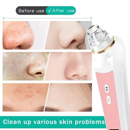 https://img.crazysales.com.au/products_pictures/363/363383_3248268_F.jpg
