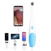 Visual Intraoral Camera WIFI Oral Examination Camera USB Oral Dental Care Mirror 300K Pixels Multi Function Tooth Camera Endoscope Christmas Gift