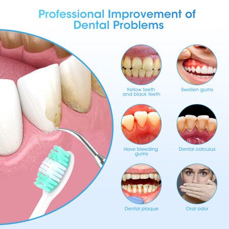 https://img.crazysales.com.au/products_pictures/363/363629_3251513_F.jpg