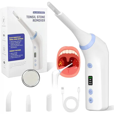 Electric Tonsil Stone Remover, Gentle Precise and Safe Removal with 3-Type Adjustable Suction and LED Light, Food-Grade Material, Rechargeable