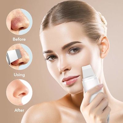 This Electronic Skin Spatula Will Clean Out Your Pores - Blackhead Removal  Spatula