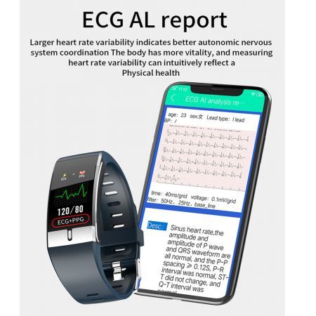 Smart Watch Body Temperature ECG PPG Heart Rate Blood Pressure Oxygen Fitness Tracker Col. Dark Blue