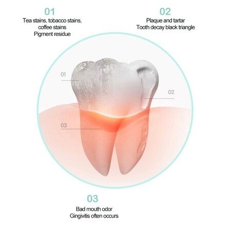 Electric Tartar Remover Sonic Dental Scaler Set Portable Ultrasonic Calculus Smoke Stains Tartar Plaque Teeth Whitening Clean