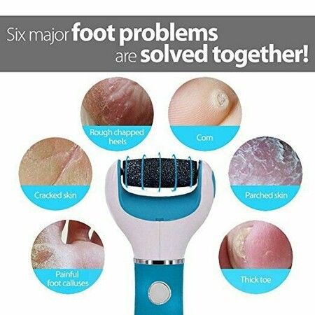 Electronic Foot File Callus Remover: Pedicure Tools Scrubber Kit Electric Shaver