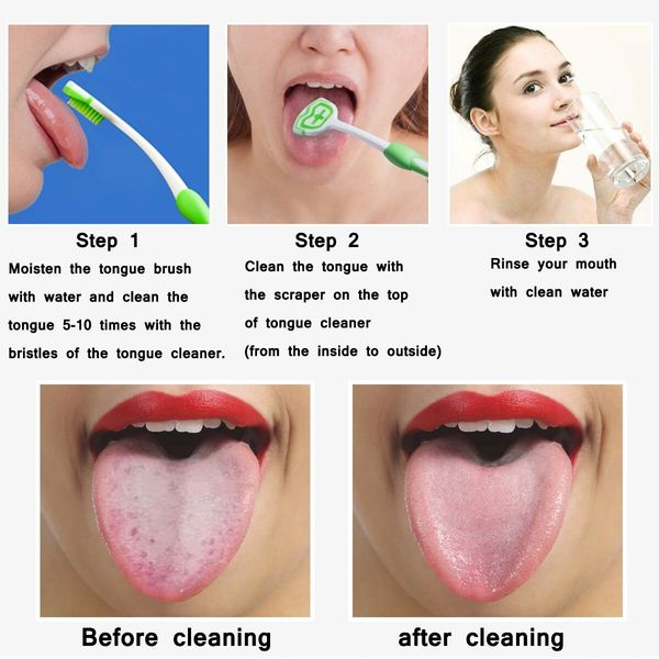 Tongue Brush, Tongue Scraper, Tongue Cleaner Helps Fight Bad Breath 2 Pack