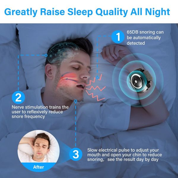 Anti Snoring Devices,Sleep Connection Anti-Snore Wristband,Provides The Effective Snoring Solution to Stop Snoring,Improve Nighttime Sleeping