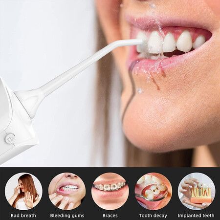 Oral Irrigator Ipx7 Rechargeable Professional Cordless Water Pick Custom Oral Irrigator Cordless Oral Irrigator