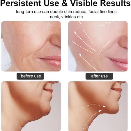 Firming Wrinkle Removal Facial Massager Tool for Face and Neck
