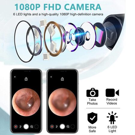 Smart WiFi Visual Earscoop Camera with 4.9 mm 1080P FHD Camera & 6 LED Lights Waterproof Lens for IOS Android(1 Pack-White)