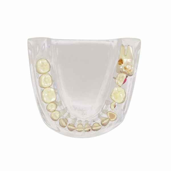 Clear Dental Model, Human Body Anatomy Replica of Jaw Teeth for Dentist Office Educational Tool