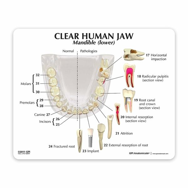 Clear Dental Model, Human Body Anatomy Replica of Jaw Teeth for Dentist Office Educational Tool