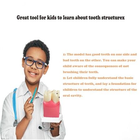 Dental Teeth Model Dental Caries Tooth Model Patient Education Teeth Model 6 Times Caries