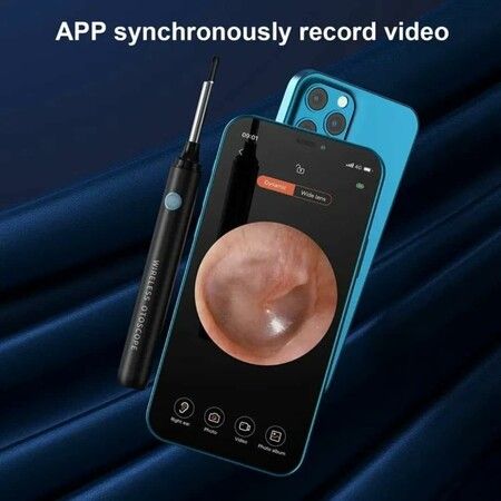 Ear Wax Cleaner, Wireless Camera, Connect Phone Directly via WiFi, Crystal Clear Images