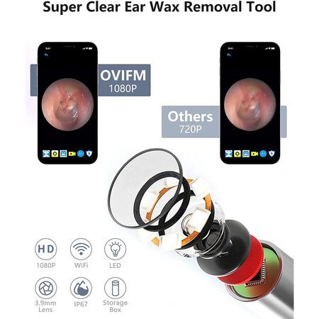 Ear Wax Removal Tool Camera Ear Cleaner Earwax Removal Kit for Adults Kids and Pets