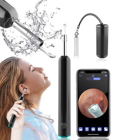 Ear Wax Removal Tool Camera Ear Cleaner Earwax Removal Kit for Adults Kids and Pets