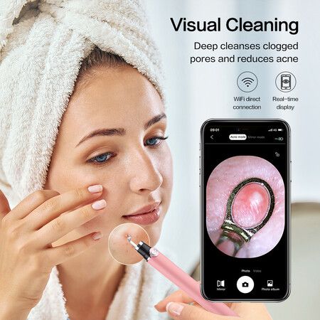 Smart Visual Blackhead Remover Acne Needle Cleansing Cosmetic Devices Acne Squeeze Pore Cleaner Facial Treatment With Camera Color Pink