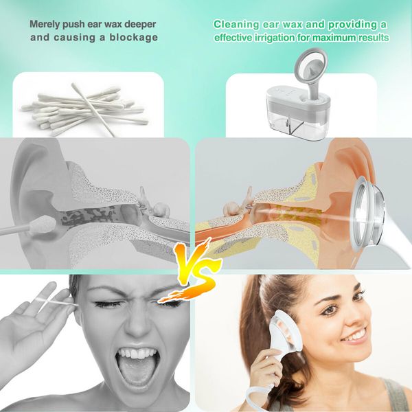 Ear Wax Removal, Electric Ear Irrigator Kit with 4 Pressure Modes, Safe and Effective Ear Wax Removal Tool, Ear Rinse Kit (white)