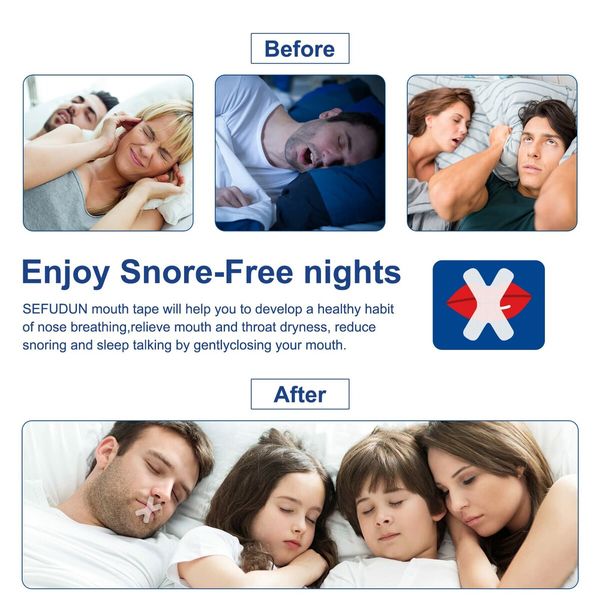 SleepSloth Mouth Tape for Better Sleep - 60 Count Anti-Snoring Strips for Improved Nose Breathing and Snore Reduction