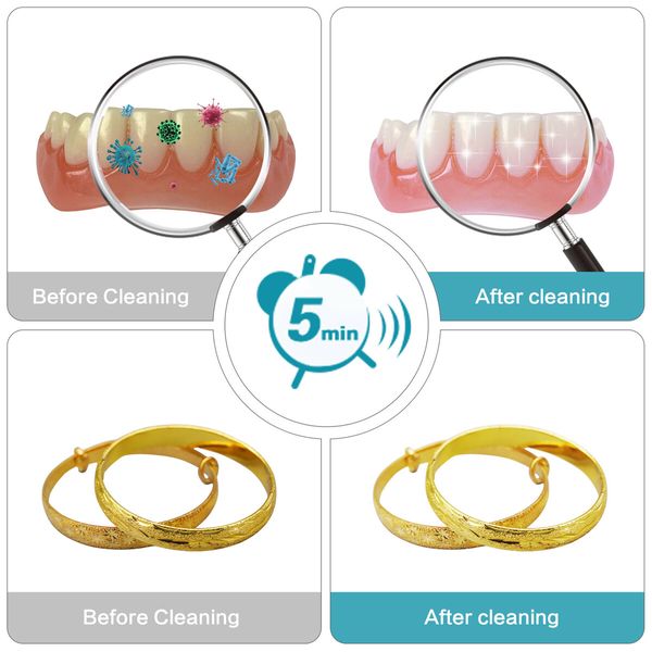 Ultrasonic UV Cleaner for Dentures Aligner Retainer Cleaning Device Machine Whitening Tray Jewelry Diamond Ring