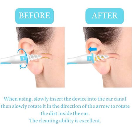 Earwax Remover Spiral Ear Wax Removal Tool, Reusable Earwax Removal Kit Safe Ear Cleaner with 16 Pcs Soft and Flexible Replaceme