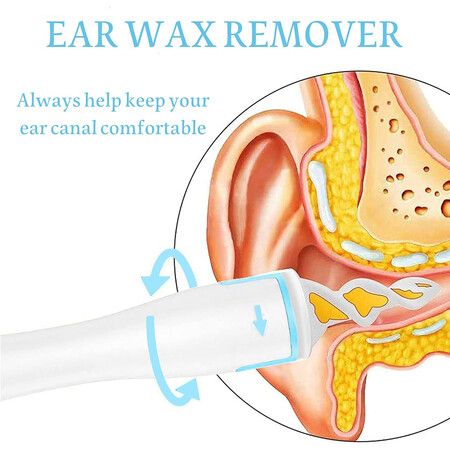 Earwax Remover Spiral Ear Wax Removal Tool, Reusable Earwax Removal Kit Safe Ear Cleaner with 16 Pcs Soft and Flexible Replaceme