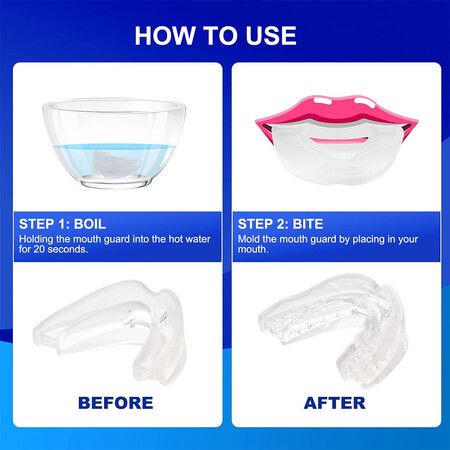 Anti Snoring Mouth Guard, Anti Snoring Mouthpiece, Snoring Solution Reusable Mouth Guard for Man