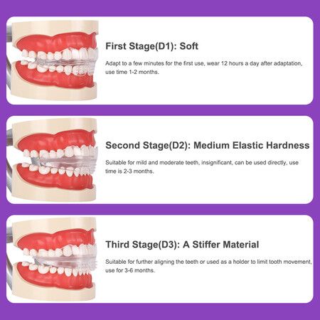 3 Stages Dental Orthodontic Braces Teeth Retainer Bruxism Mouth Guard Teeth Straightener Device