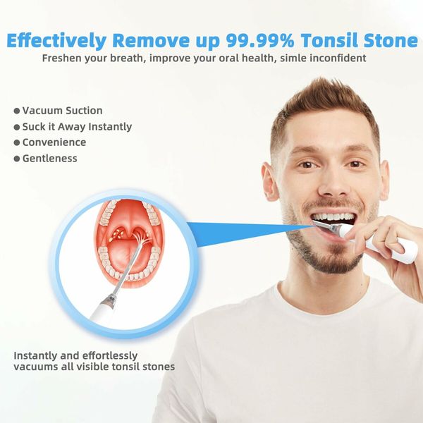 Tonsil Stone Remover Electronic Vacuum Stone Removal Kit, 5 Modes Instant Suction Tool, Easy to Use, Fresh Breath, Mouth Cleaning Oral Care